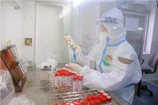 Image Xét nghiệm virus SARS-CoV-2 bằng kỹ thuật Realtime RT-PCR