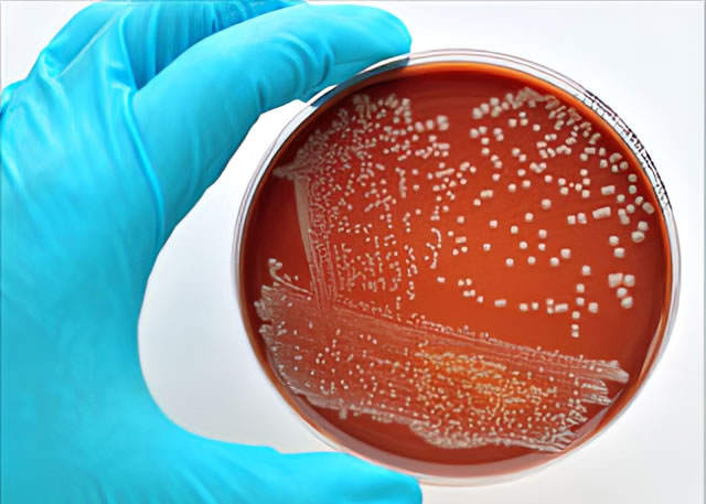 Vi khuẩn E.Coli không 'lành' như bạn vẫn nghĩ và 5 chìa khóa phòng ngộ độc thực phẩm - Ảnh 3