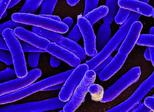 Vi khuẩn E.Coli không 'lành' như bạn vẫn nghĩ và 5 chìa khóa phòng ngộ độc thực phẩm