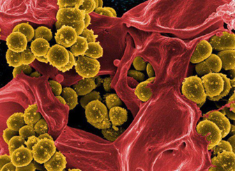 staphylococcus-aureus-can-proliferate-in-contaminated-food-and-produce-toxins-that-cause-food-poisoning