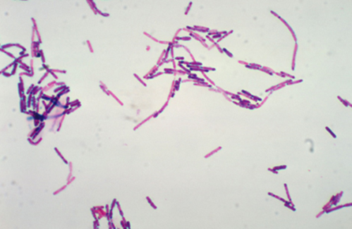 Cereulide -  the emetic toxin of Bacillus cereus and its food safety risk